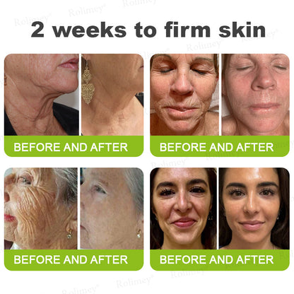 👨‍⚕️💛Made and shipped from South Africa💫Rolimey® Botox & Vita-A Retinol Shot Wrinkle-Lift Tightening cream - Last Day Promotion 70% OFF