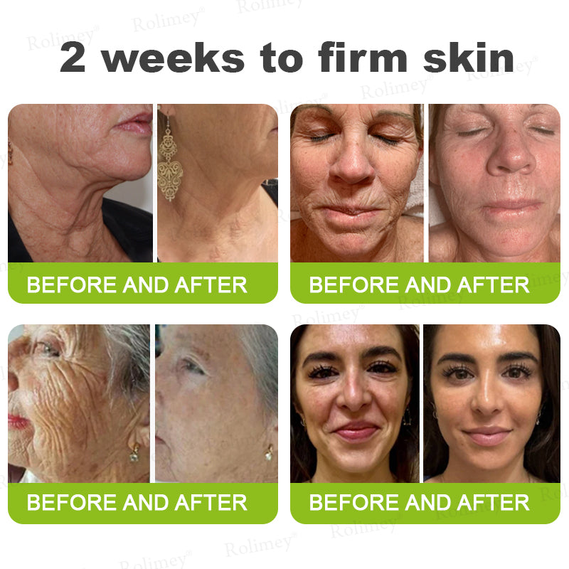 🇳🇿Made and shipped from the NZ 💥Rolimey® Botox & Vita-A Retinol Shot Wrinkle-Lift Tightening cream - Last Day Promotion 70% OFF