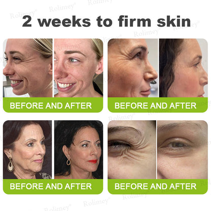 🇳🇿Made and shipped from the NZ 💥Rolimey® Botox & Vita-A Retinol Shot Wrinkle-Lift Tightening cream - Last Day Promotion 70% OFF