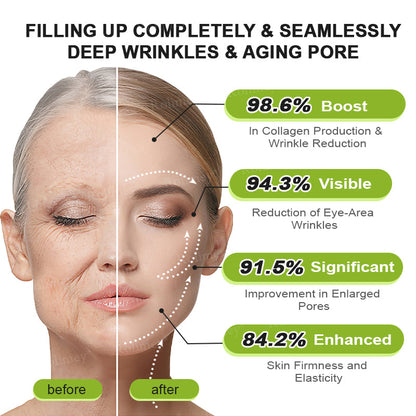 🇳🇿Made and shipped from the NZ 💥Rolimey® Botox & Vita-A Retinol Shot Wrinkle-Lift Tightening cream - Last Day Promotion 70% OFF