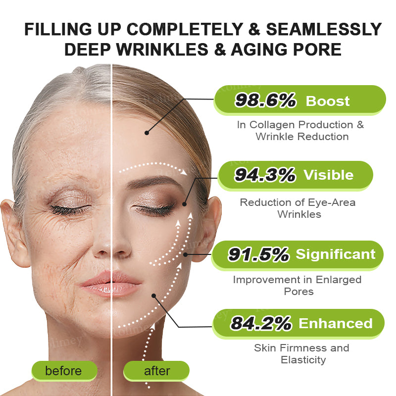 👨‍⚕️💛Made and shipped from South Africa💫Rolimey® Botox & Vita-A Retinol Shot Wrinkle-Lift Tightening cream - Last Day Promotion 70% OFF