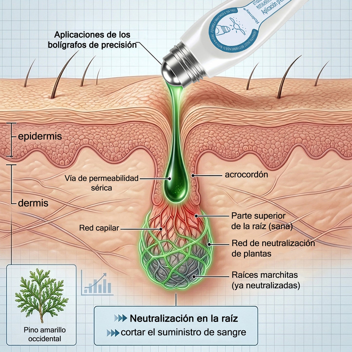 ✅Rolimey® Roll-on eliminador de verrugas cutáneas y manchas (tratamiento de 7 días)👩‍⚕️
