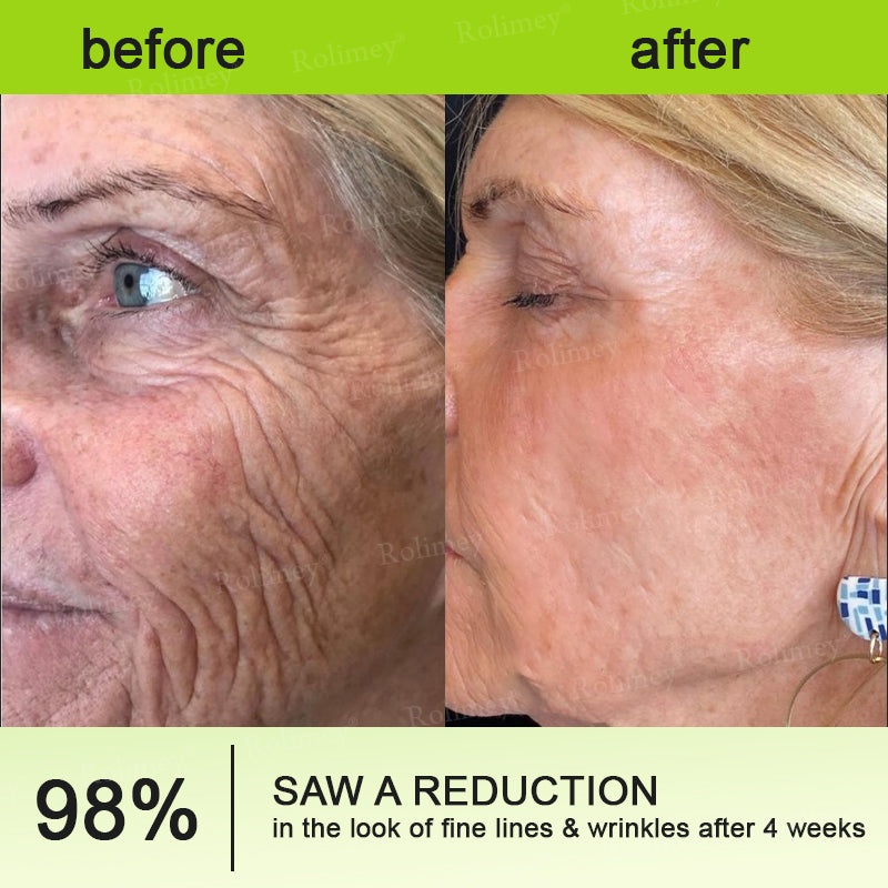 🇳🇿Made and shipped from the NZ 💥Rolimey® Botox & Vita-A Retinol Shot Wrinkle-Lift Tightening cream - Last Day Promotion 70% OFF