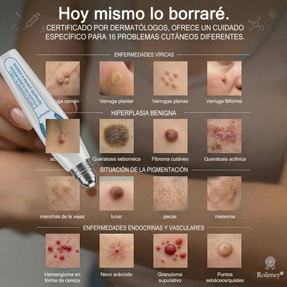 ✅Rolimey® Roll-on eliminador de verrugas cutáneas y manchas (tratamiento de 7 días)👩‍⚕️