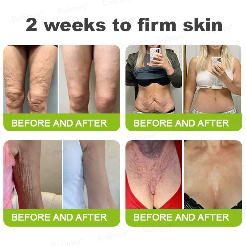 🇳🇿Made and shipped from the NZ 💥Rolimey® Botox & Vita-A Retinol Shot Wrinkle-Lift Tightening cream - Last Day Promotion 70% OFF