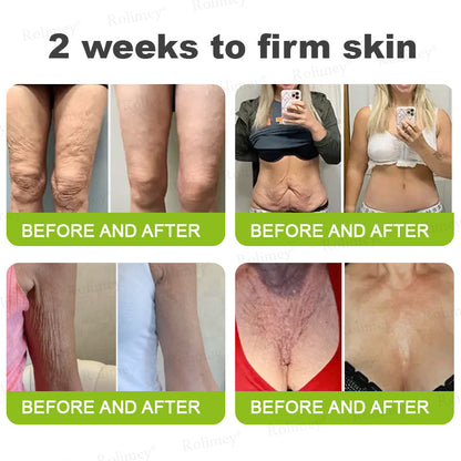🇳🇿Made and shipped from the NZ 💥Rolimey® Botox & Vita-A Retinol Shot Wrinkle-Lift Tightening cream - Last Day Promotion 70% OFF
